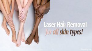 Laser Hair Removal For All Sin Types!